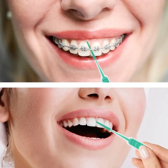 Dr. Emma Dental-Picks 100st